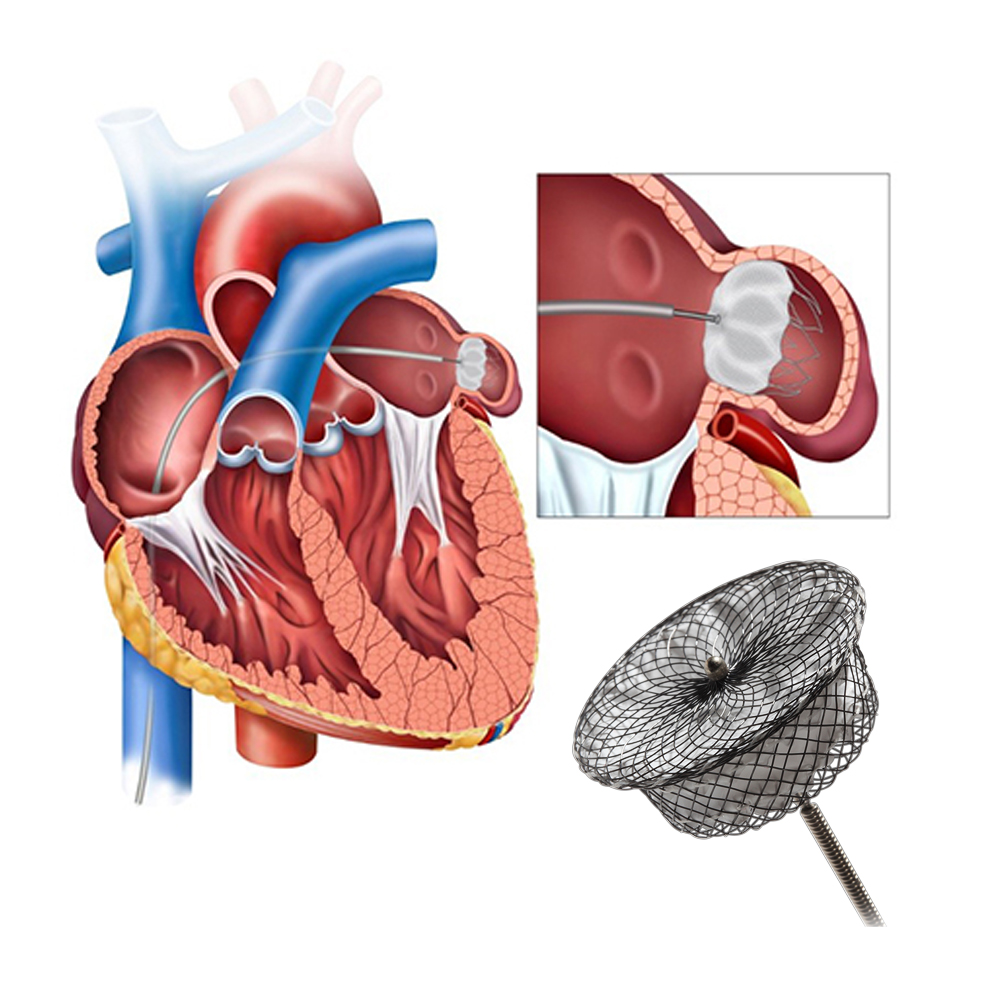 The Ultimate Guide to Nitinol Wire for Your Business