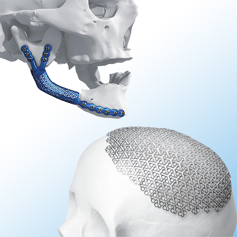 Precision Pt-Ir 90/10 Capillary Tube for Pacemaker Electrodes & Leads