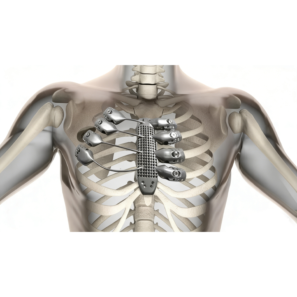 Durable Platinum Iridium Seamless Tube for Long-Term Medical Implants