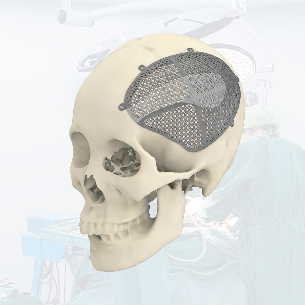 Advanced Platinum Iridium Tubing for Cardiovascular Implantable Advanced Platinum Iridium Tubing for Cardiovascular Implantable