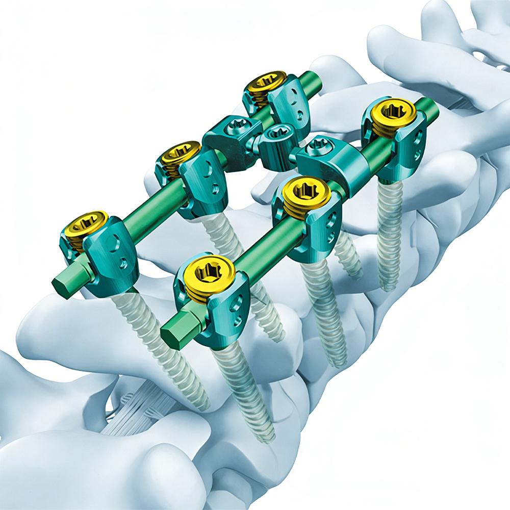 Medical Implantable Nitinol Compression Springs Shape Memory Custom Medical Implantable Nitinol Compression Springs Shape Memory Custom