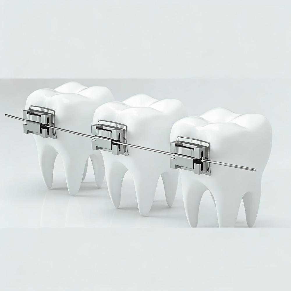 Why Nitinol Wire Is the Best Choice for Orthodontic Treatment Why Nitinol Wire Is the Best Choice for Orthodontic Treatment