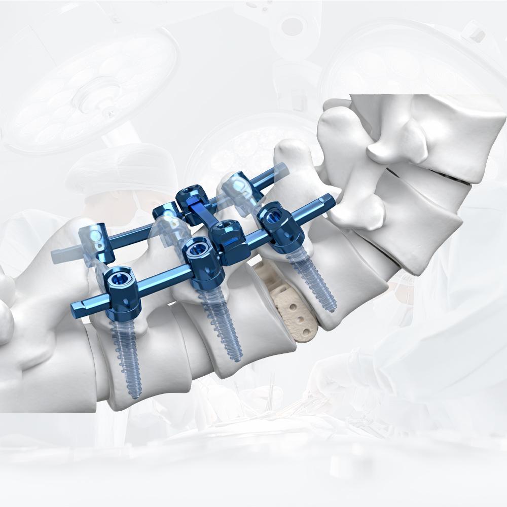 Advanced Nitinol Wire Bulk for Implantable Devices in Medical