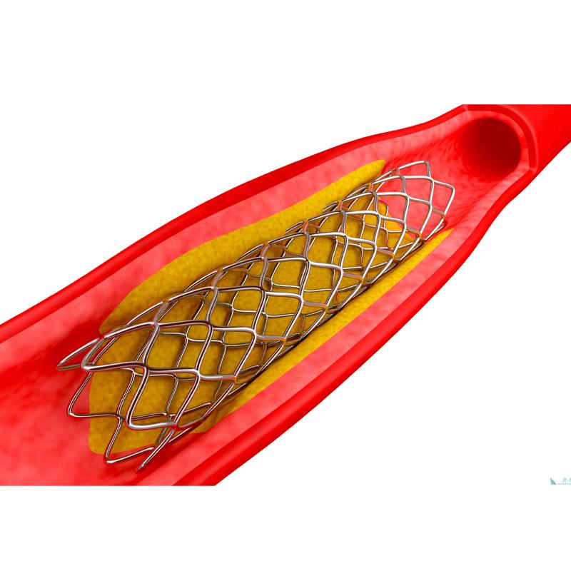 Advanced Nitinol Wire Bulk for Implantable Devices in Medical